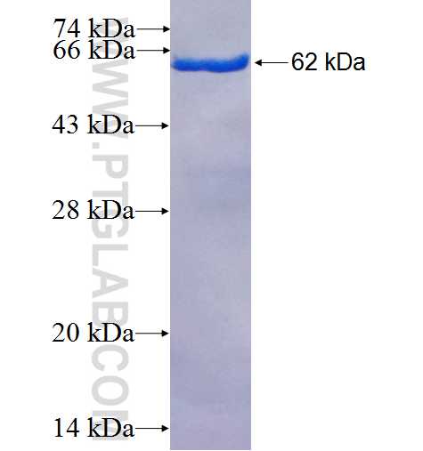 TLK2 fusion protein Ag5022 SDS-PAGE