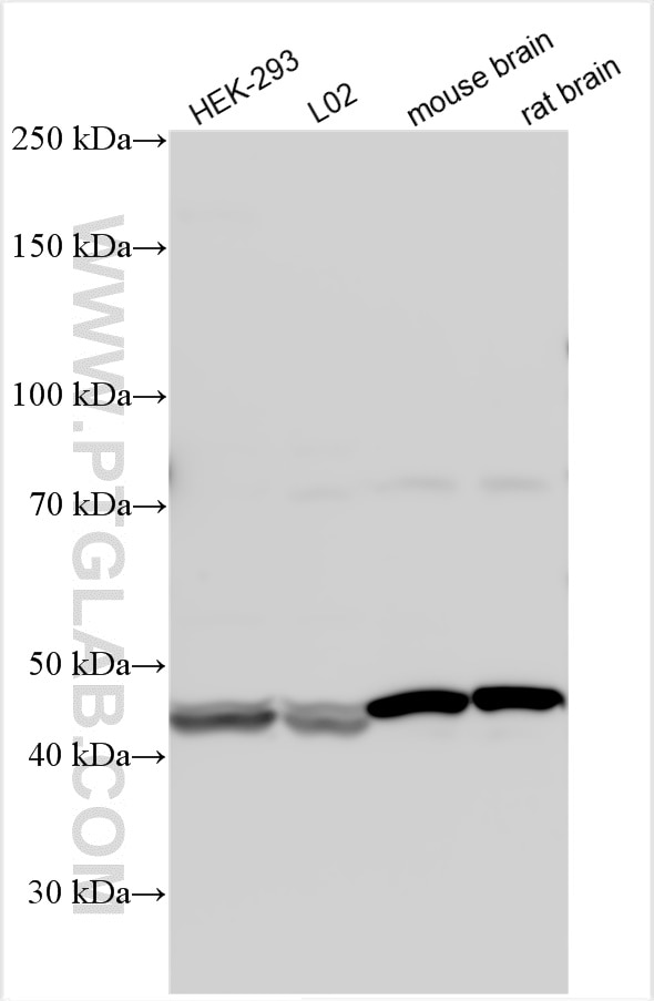 Western Blot (WB) analysis of various lysates using TLL1 Polyclonal antibody (19160-1-AP)