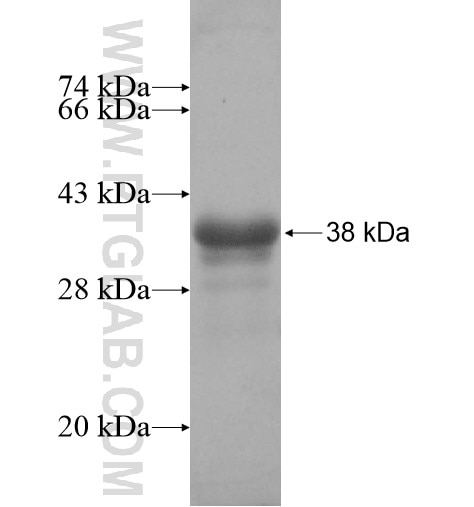 TLL1 fusion protein Ag13639 SDS-PAGE