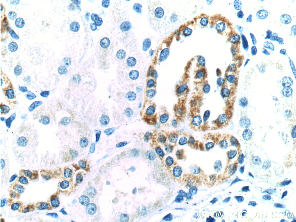 Immunohistochemistry (IHC) staining of human kidney tissue using TLL2 Polyclonal antibody (21546-1-AP)
