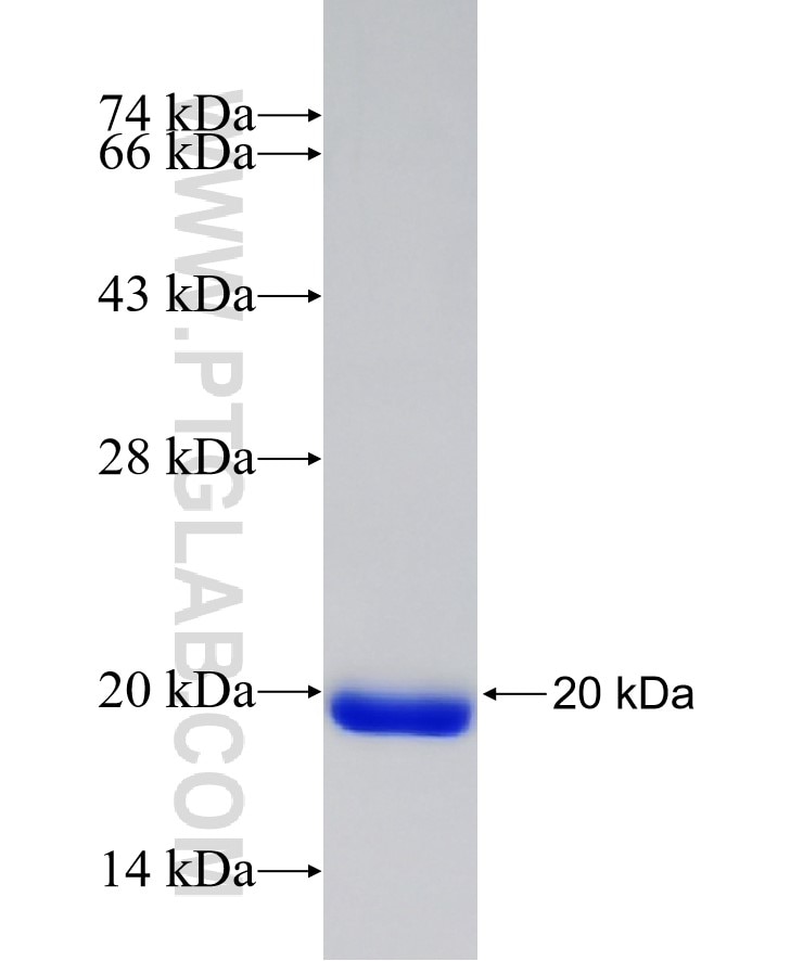 TLL2 fusion protein Ag17009 SDS-PAGE