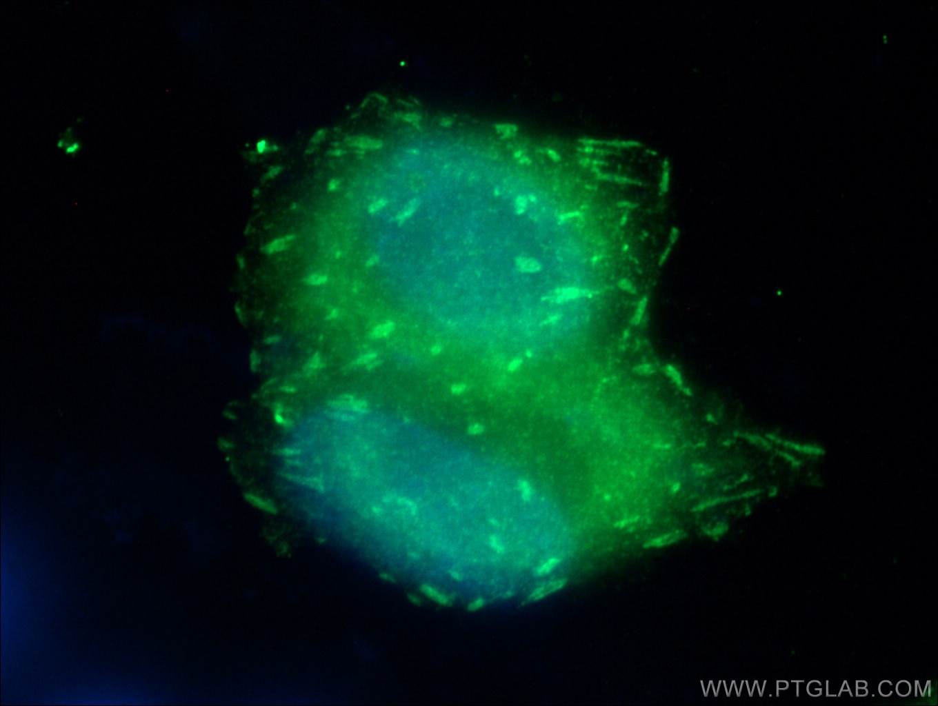 Immunofluorescence (IF) / fluorescent staining of HeLa cells using Talin-1 Polyclonal antibody (14168-1-AP)
