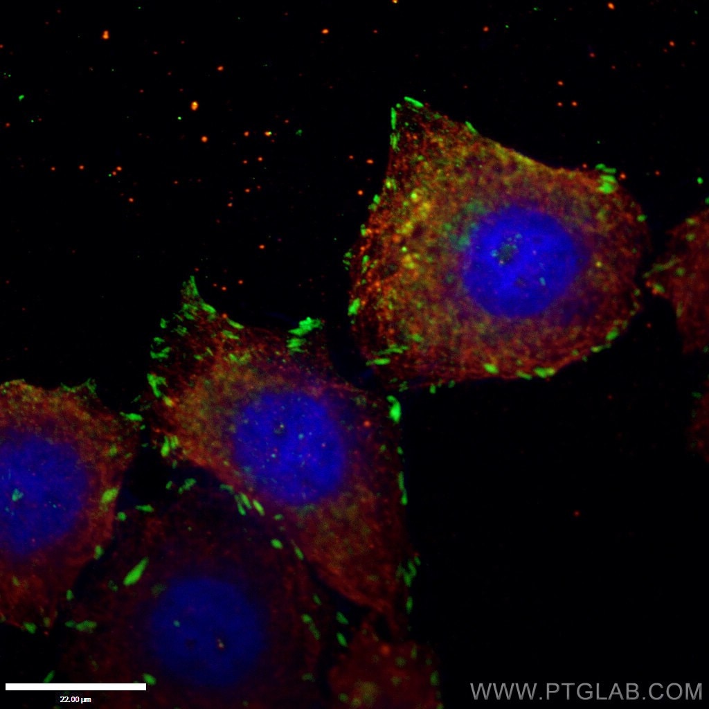 IF Staining of HepG2 using 14168-1-AP