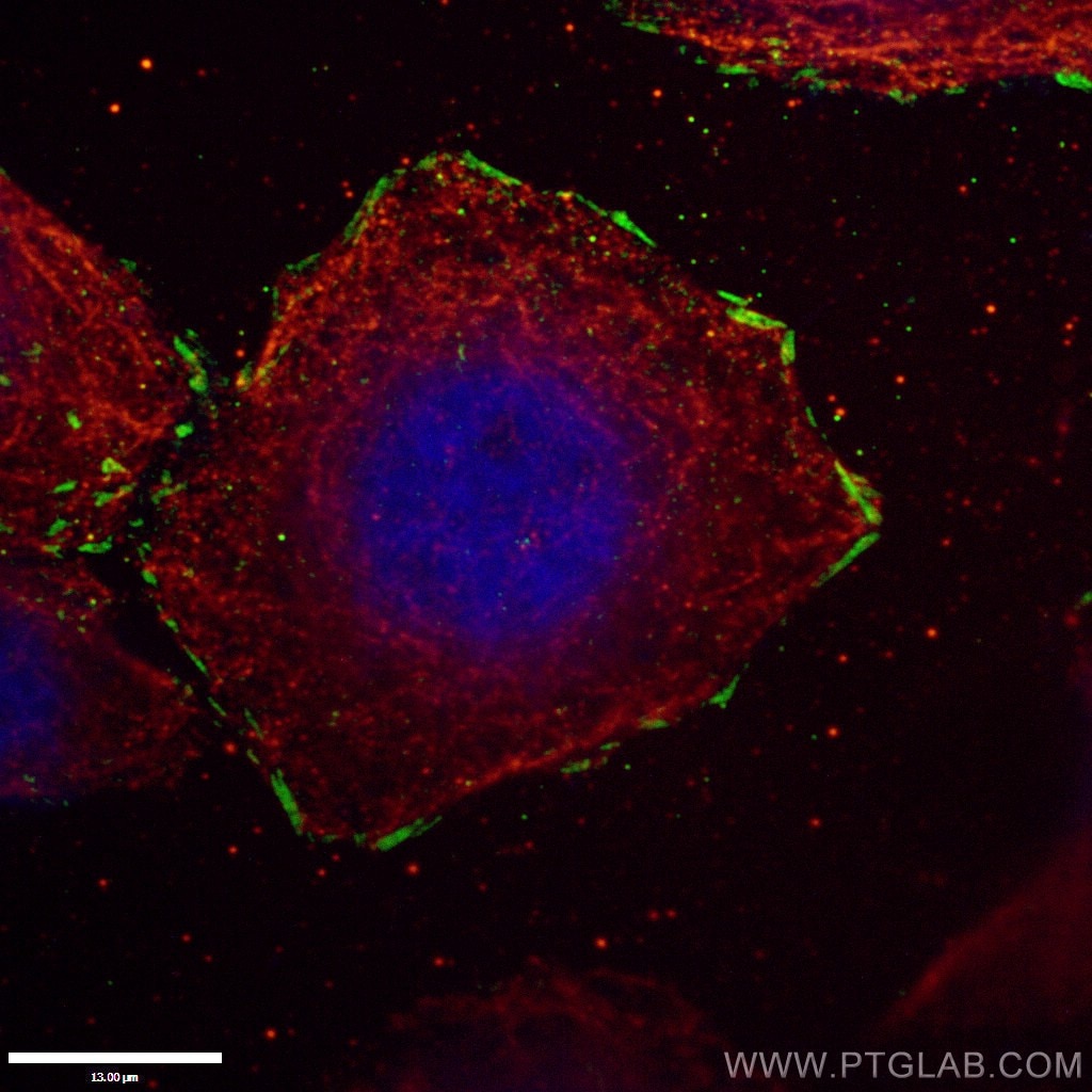 IF Staining of HepG2 using 14168-1-AP