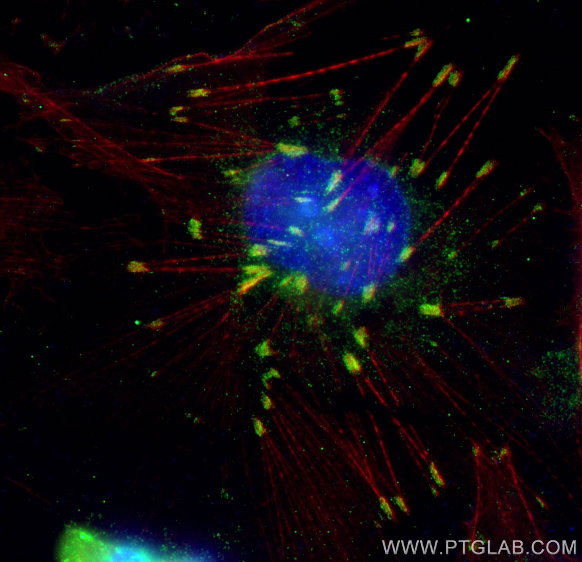 Immunofluorescence (IF) / fluorescent staining of HUVEC cells using Talin-1 Polyclonal antibody (14168-1-AP)