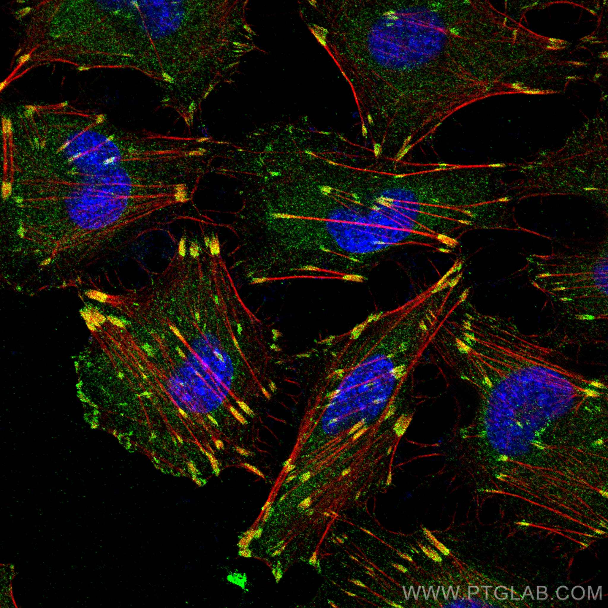 Immunofluorescence (IF) / fluorescent staining of HUVEC cells using Talin-1 Polyclonal antibody (14168-1-AP)