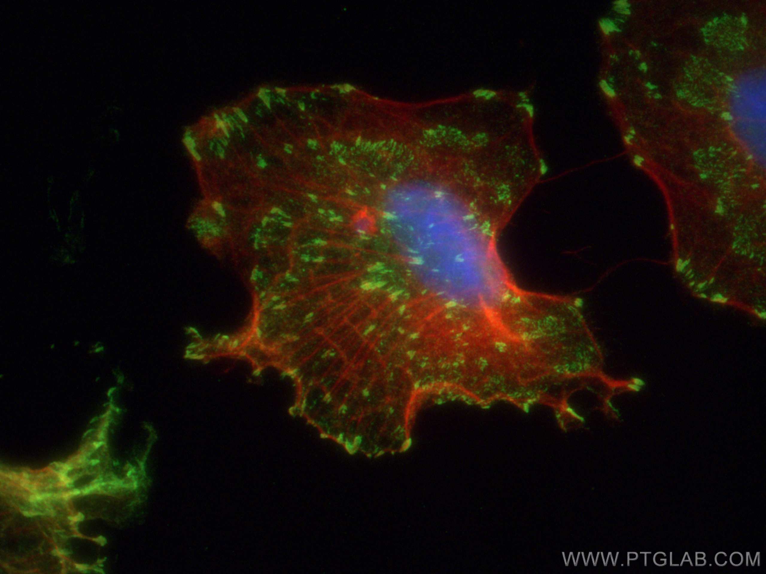 Immunofluorescence (IF) / fluorescent staining of A549 cells using Talin-1 Polyclonal antibody (14168-1-AP)