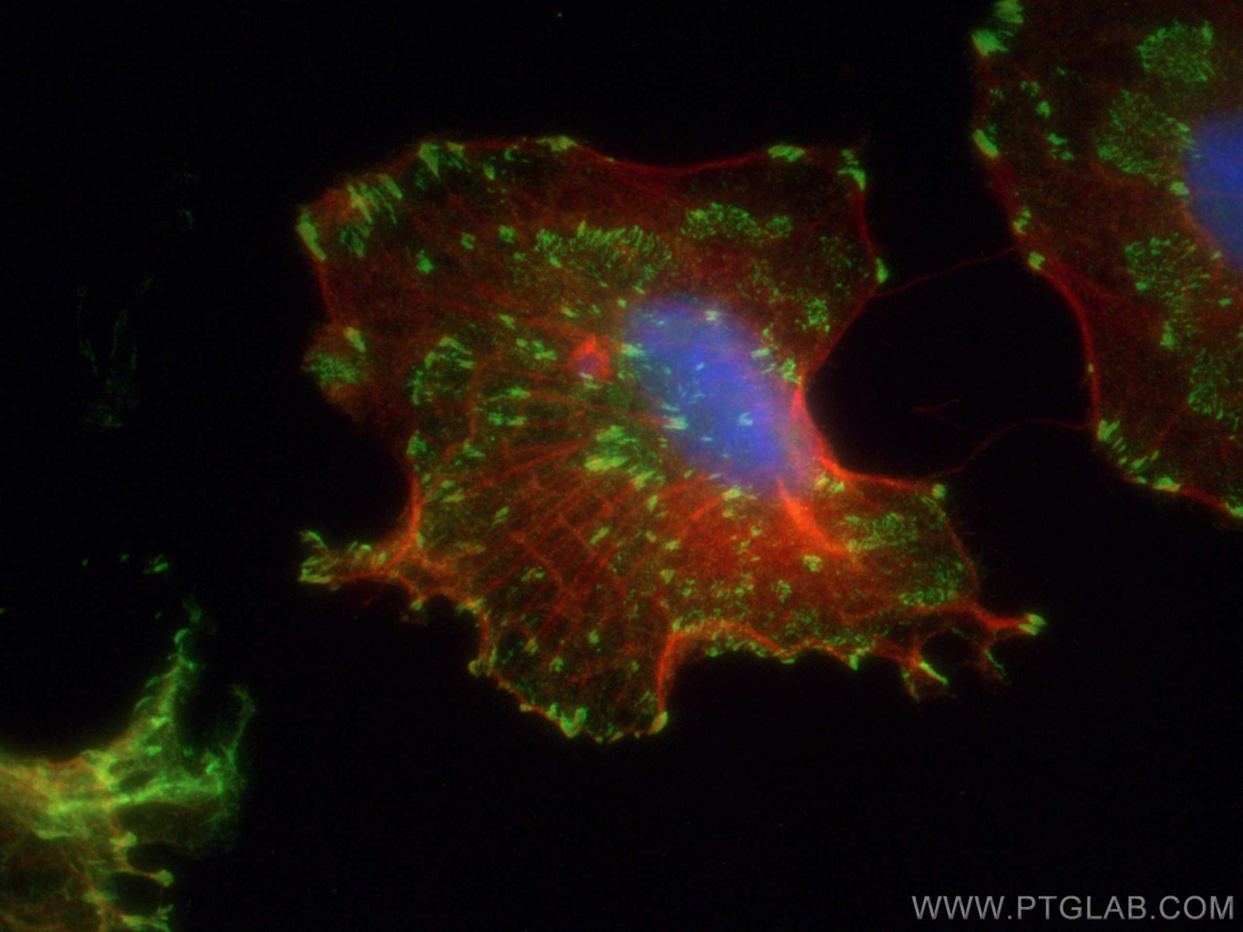 IF Staining of A549 using 14168-1-AP