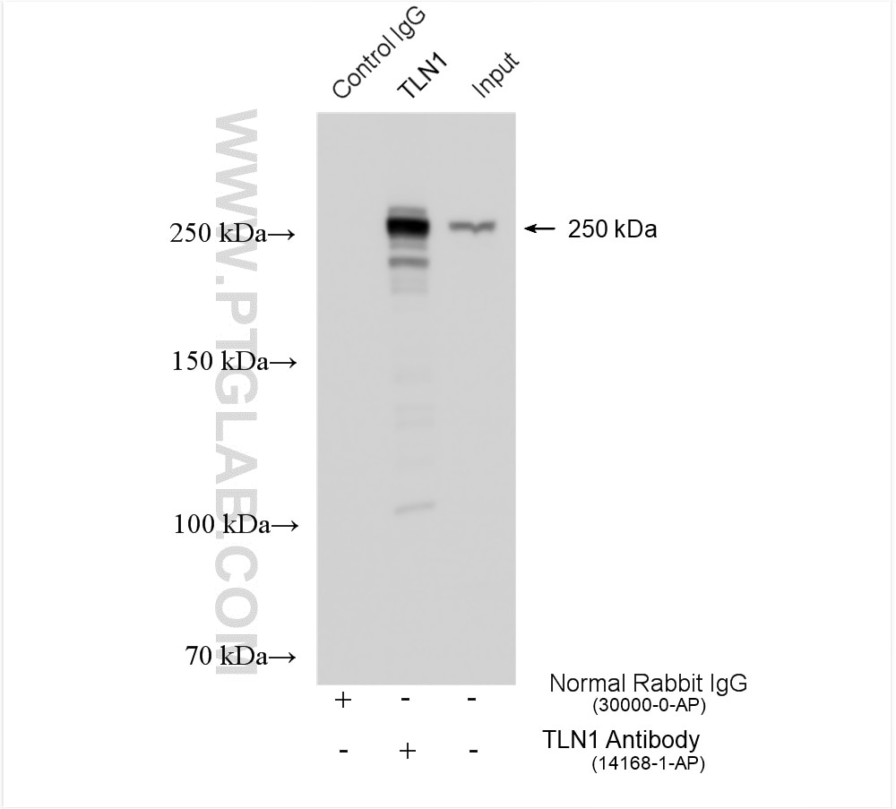 Immunoprecipitation (IP) experiment of HeLa cells using Talin-1 Polyclonal antibody (14168-1-AP)