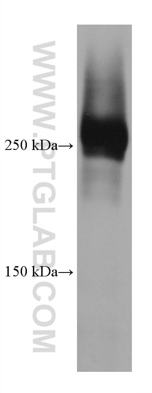 Western Blot (WB) analysis of human peripheral blood platelets using Talin-1 Monoclonal antibody (67992-1-Ig)