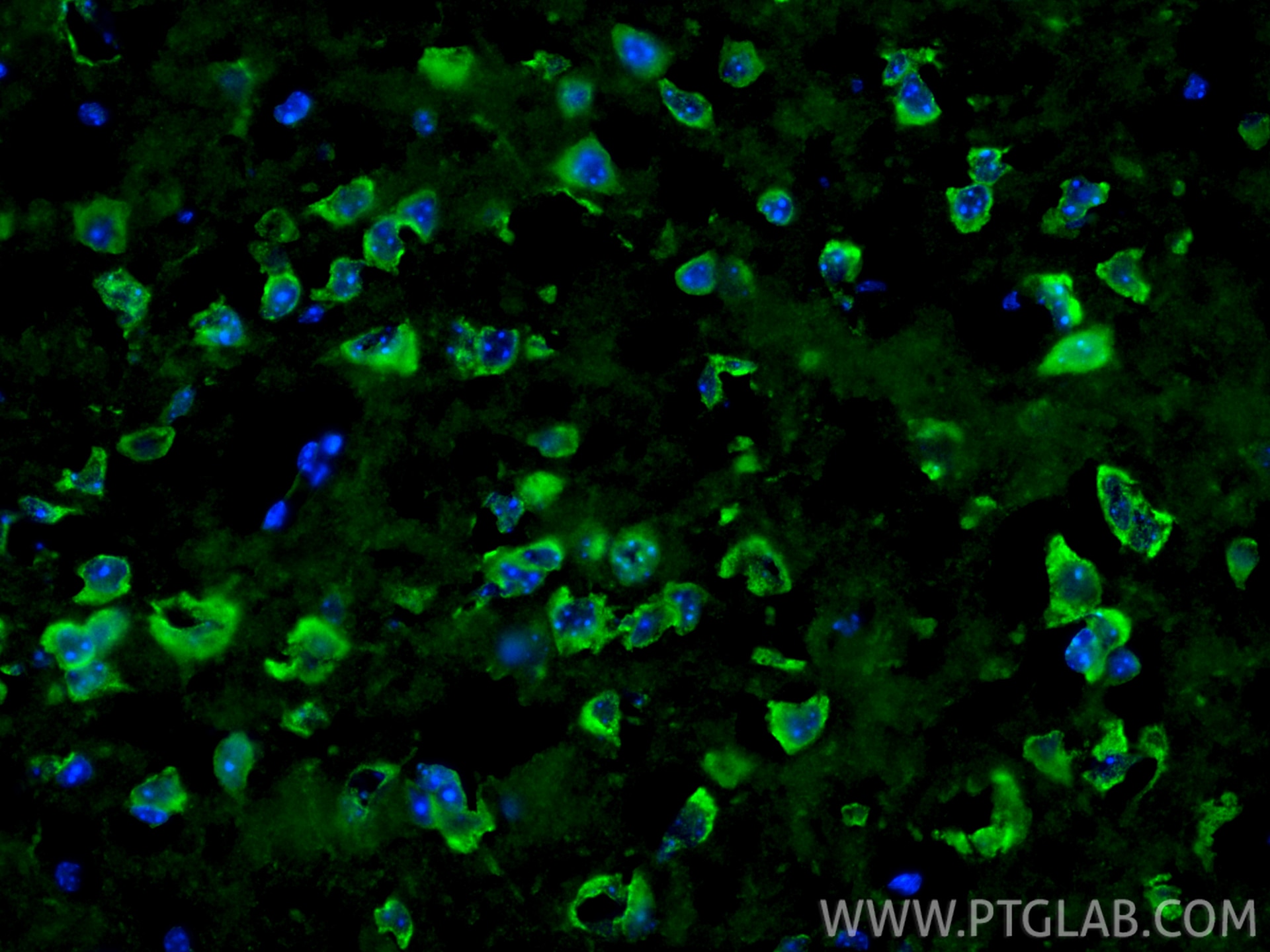 IF Staining of mouse brain using 31695-1-AP (same clone as 31695-1-PBS) Immunofluorescence (IF) / fluorescent staining of mouse brain tissue using Talin-2 Polyclonal antibody (31695-1-AP)