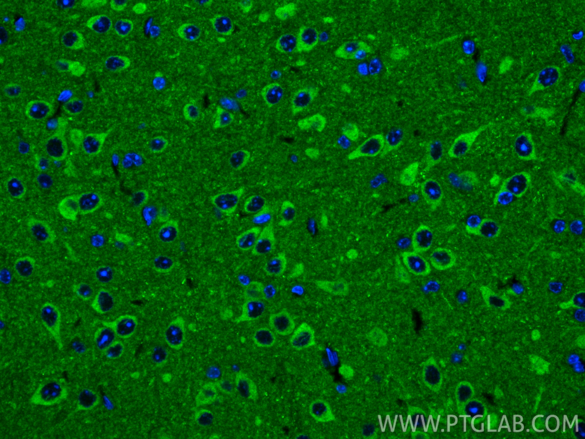 IF Staining of mouse brain using 31695-1-AP (same clone as 31695-1-PBS) Immunofluorescence (IF) / fluorescent staining of mouse brain tissue using Talin-2 Polyclonal antibody (31695-1-AP)