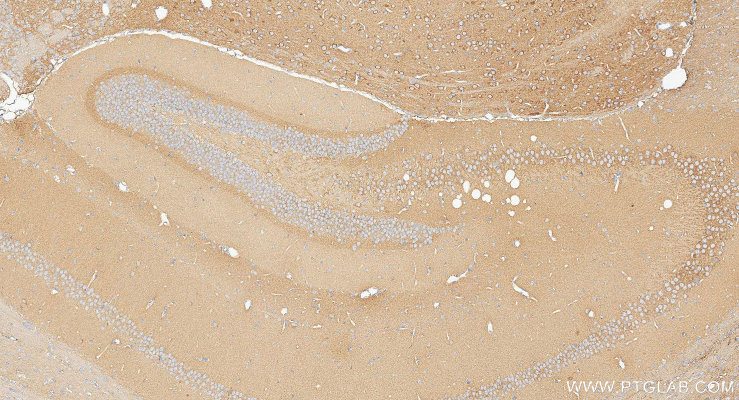IHC staining of mouse brain using 31695-1-AP (same clone as 31695-1-PBS) Immunohistochemistry (IHC) staining of mouse brain tissue using Talin-2 Polyclonal antibody (31695-1-AP)