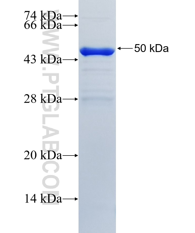 TLN2 fusion protein Ag36217 SDS-PAGE