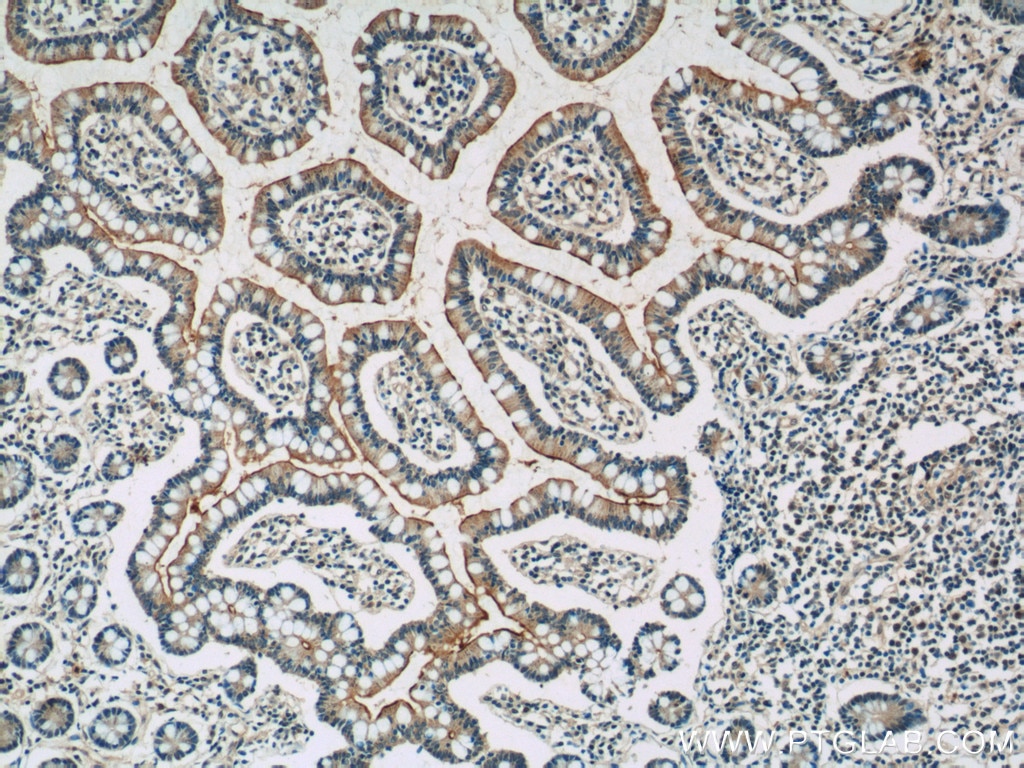 Immunohistochemistry (IHC) staining of human small intestine tissue using TLR1 Polyclonal antibody (19816-1-AP)