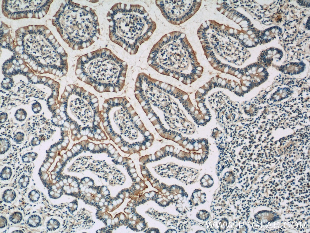 IHC staining of human small intestine using 19816-1-AP