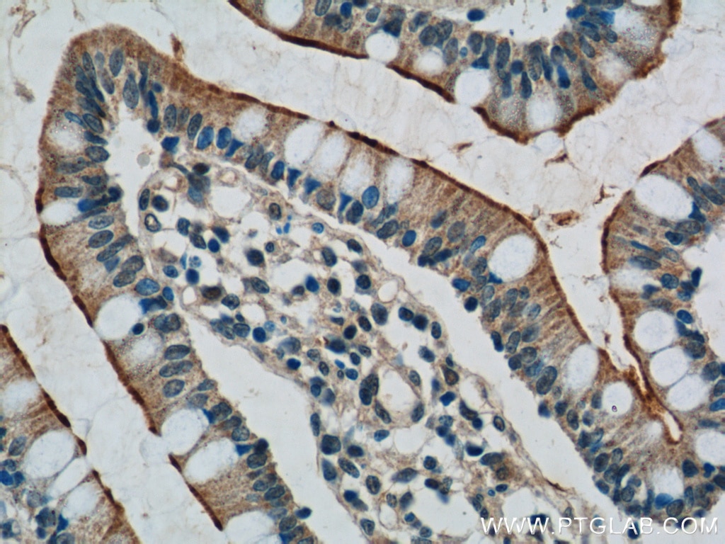 Immunohistochemistry (IHC) staining of human small intestine tissue using TLR1 Polyclonal antibody (19816-1-AP)