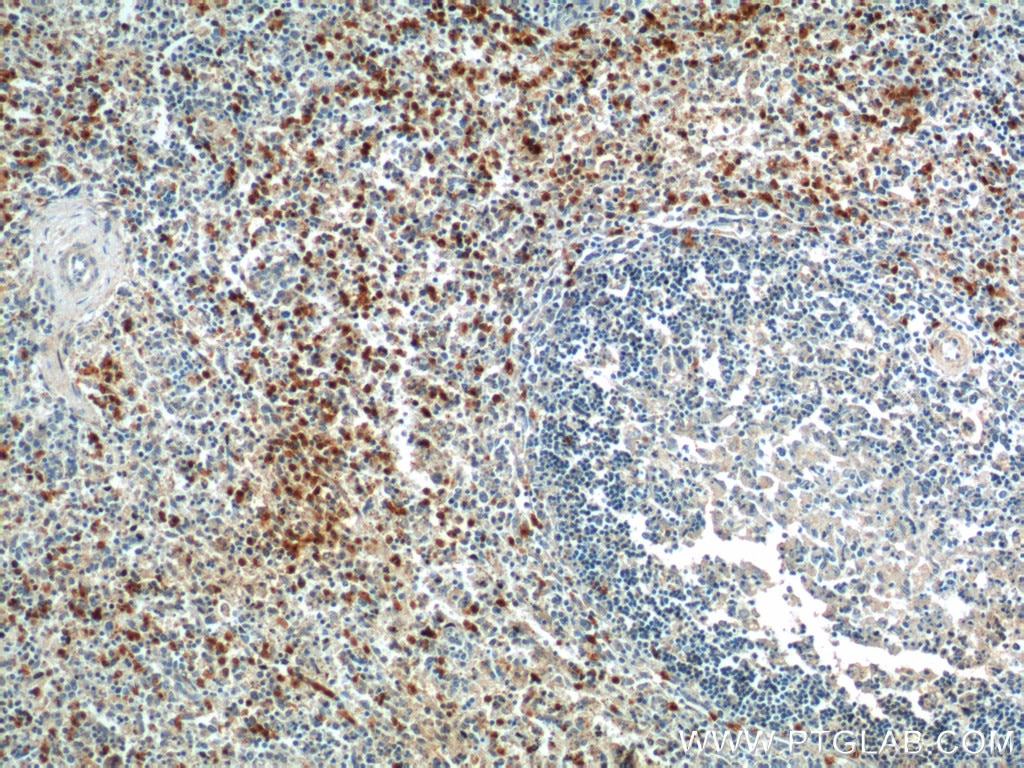 Immunohistochemistry (IHC) staining of human spleen tissue using TLR1 Polyclonal antibody (19816-1-AP)