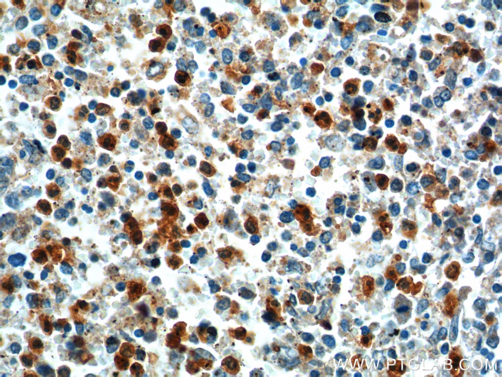 Immunohistochemistry (IHC) staining of human spleen tissue using TLR1 Polyclonal antibody (19816-1-AP)