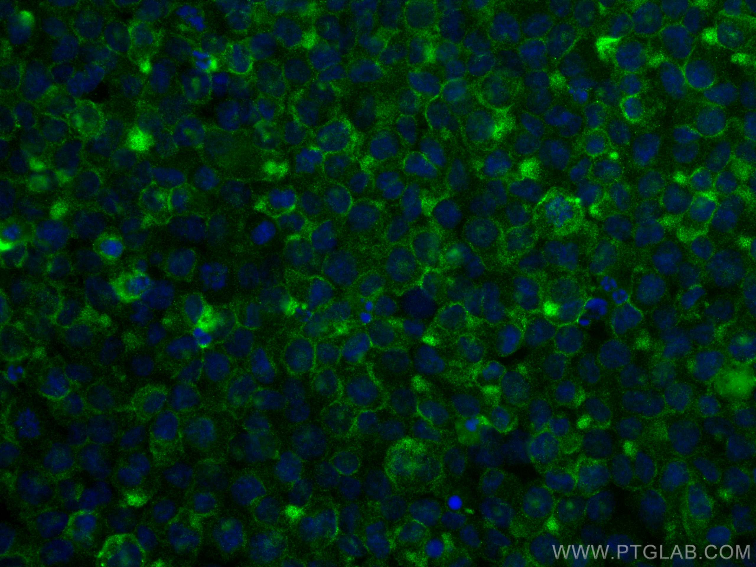 Immunofluorescence (IF) / fluorescent staining of THP-1 cells using TLR2 Monoclonal antibody (66645-1-Ig)