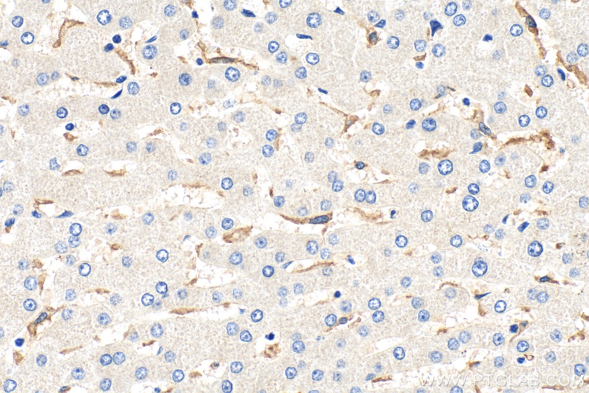 Immunohistochemistry (IHC) staining of human liver tissue using TLR2 Monoclonal antibody (66645-1-Ig)