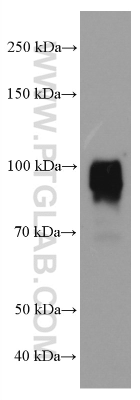 Western Blot (WB) analysis of U-937 cells using TLR2 Monoclonal antibody (66645-1-Ig)