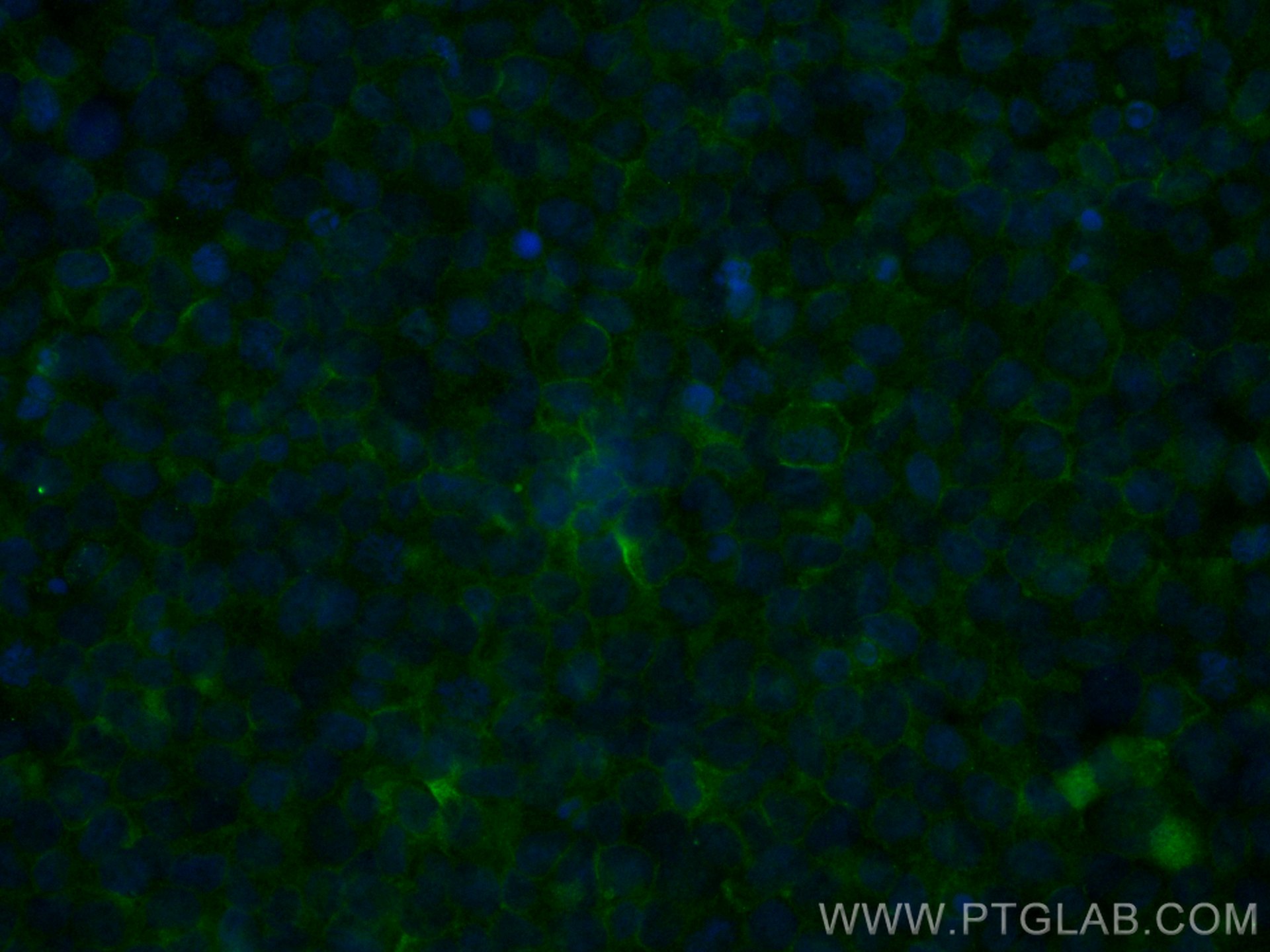 Immunofluorescence (IF) / fluorescent staining of THP-1 cells using CoraLite® Plus 488-conjugated TLR2 Monoclonal anti (CL488-66645)