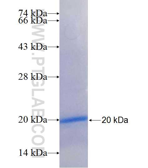 TLR2 fusion protein Ag25609 SDS-PAGE