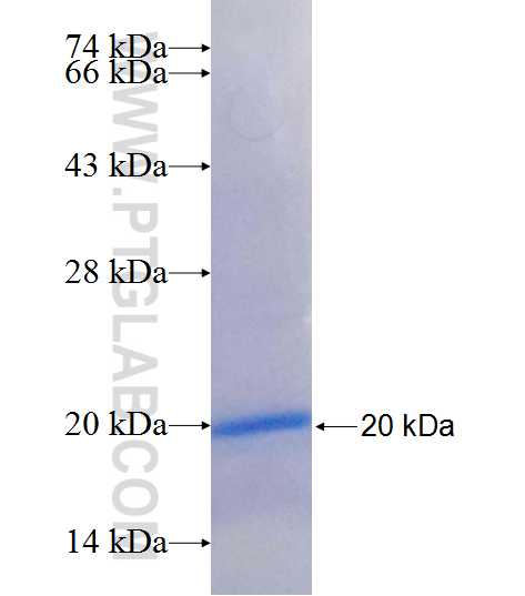 TLR2 fusion protein Ag25609 SDS-PAGE