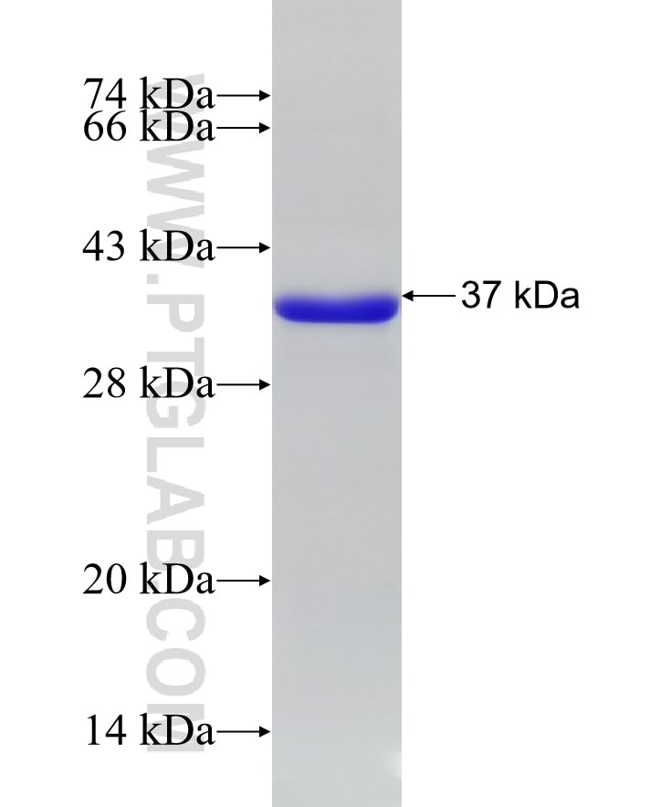 TLR2 fusion protein Ag25626 SDS-PAGE