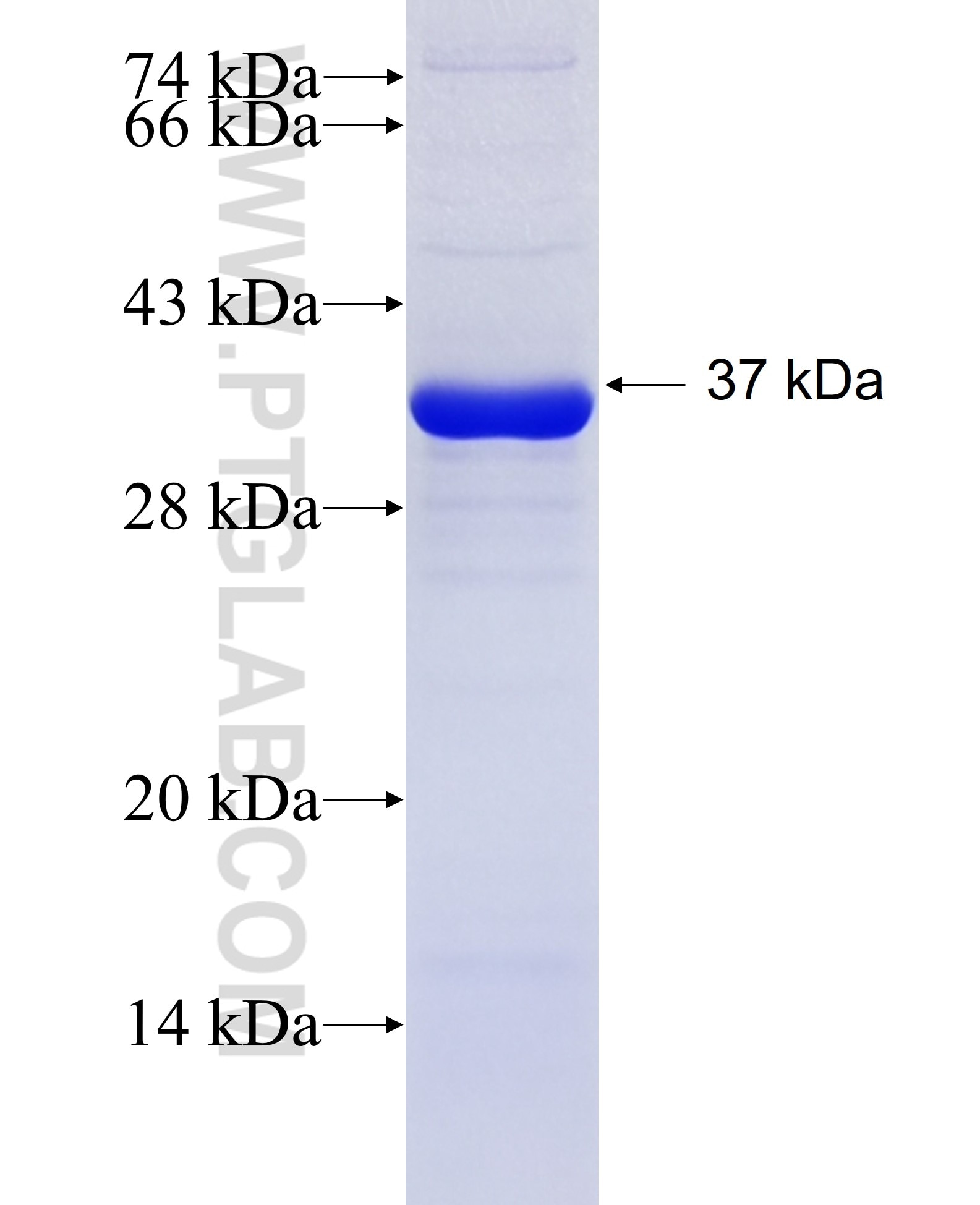 TLR2 fusion protein Ag25626 SDS-PAGE