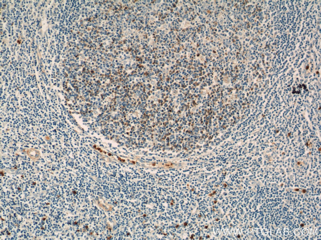 TLR3 Polyclonal antibody