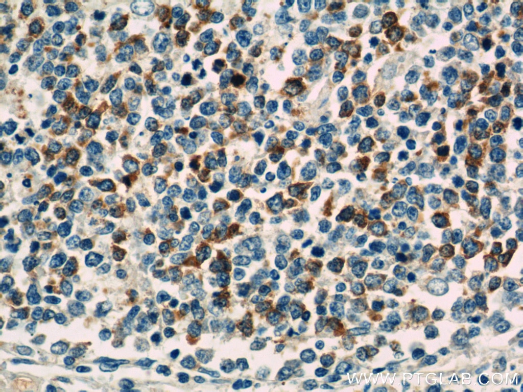 TLR3 Polyclonal antibody