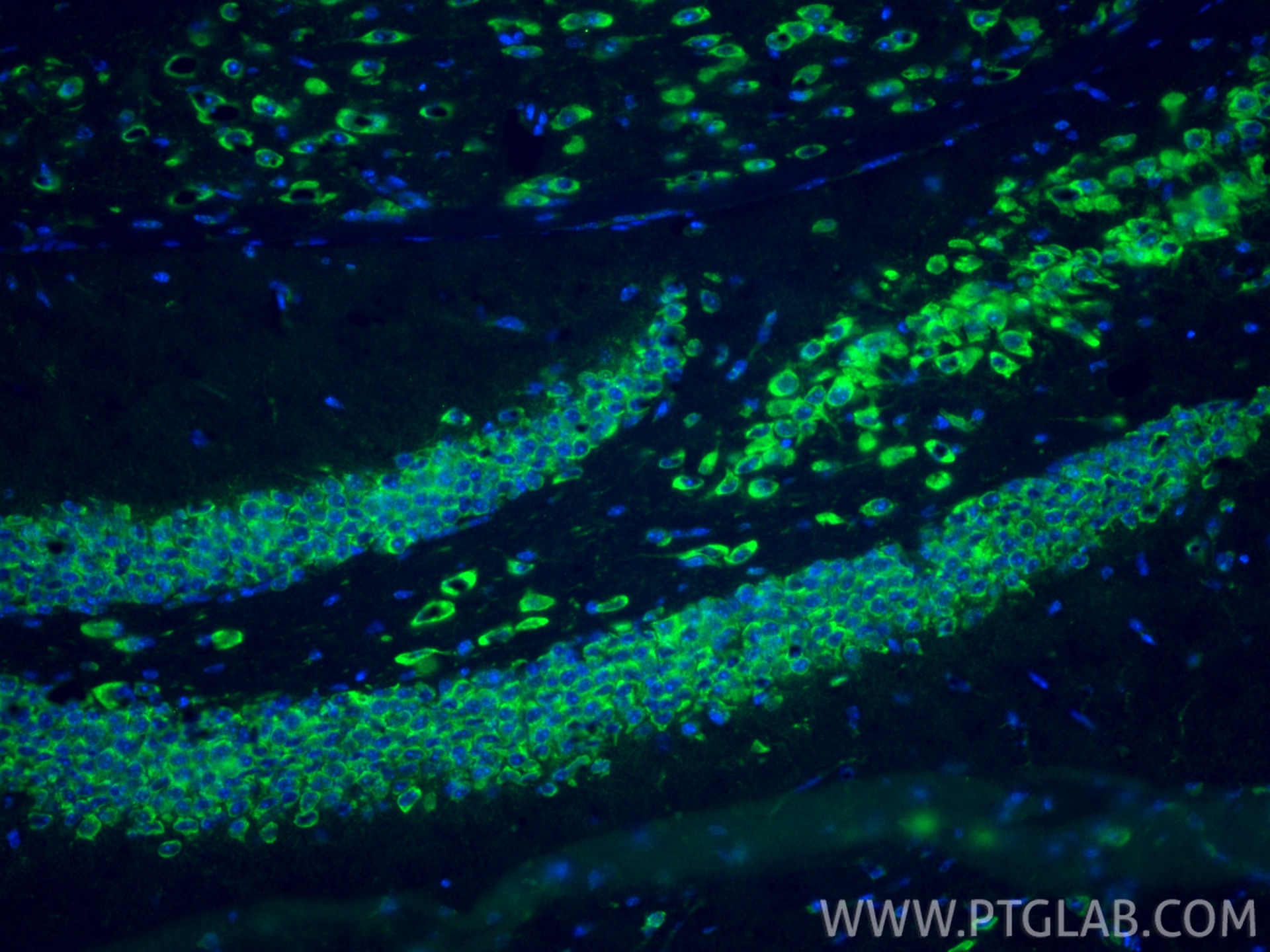 Immunofluorescence (IF) / fluorescent staining of mouse brain tissue using TLR4 Polyclonal antibody (19811-1-AP)