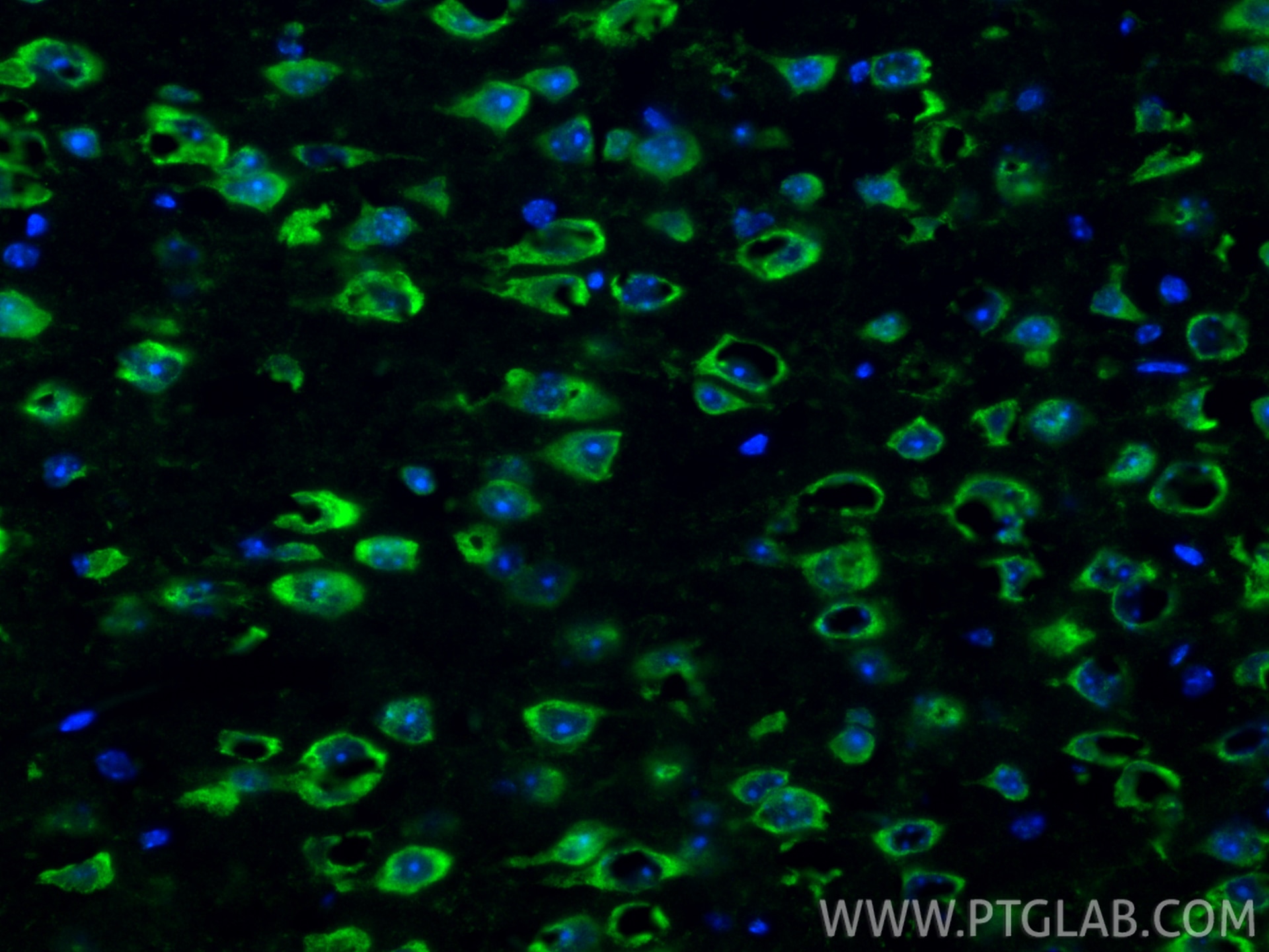 Immunofluorescence (IF) / fluorescent staining of mouse brain tissue using TLR4 Polyclonal antibody (19811-1-AP)