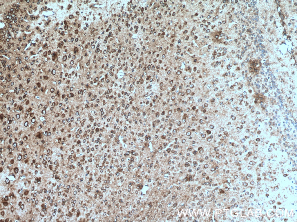 Immunohistochemistry (IHC) staining of mouse brain tissue using TLR4 Polyclonal antibody (19811-1-AP)