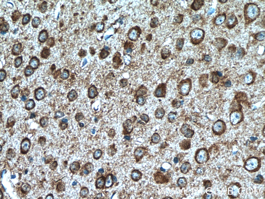 Immunohistochemistry (IHC) staining of mouse brain tissue using TLR4 Polyclonal antibody (19811-1-AP)