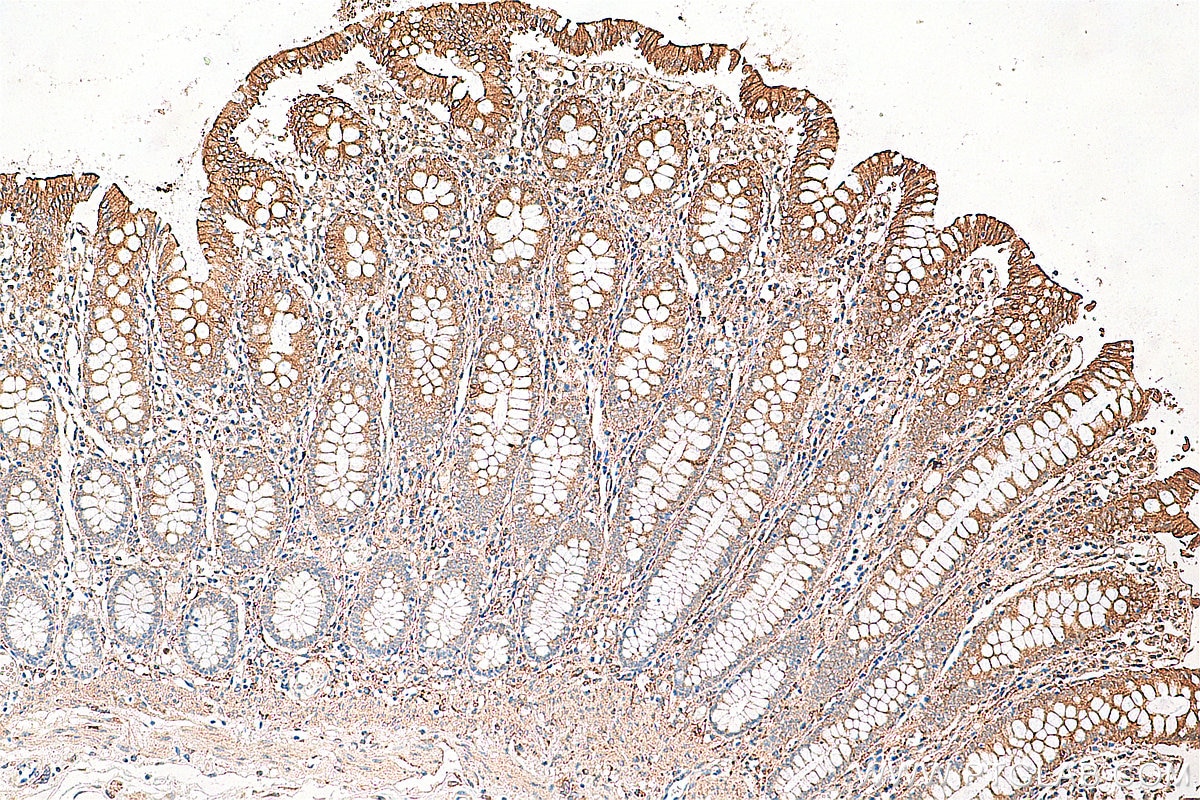 Immunohistochemistry (IHC) staining of human colon tissue using TLR4 Polyclonal antibody (19811-1-AP)