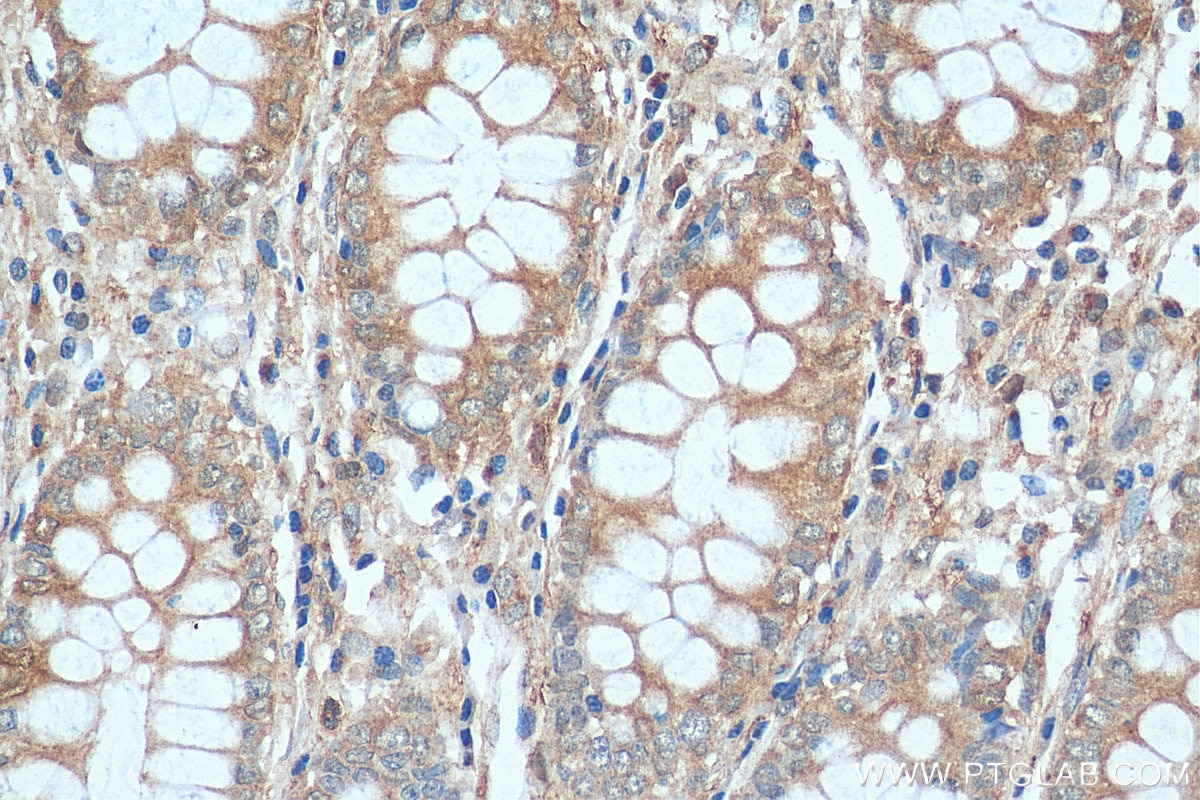 Immunohistochemistry (IHC) staining of human colon tissue using TLR4 Polyclonal antibody (19811-1-AP)