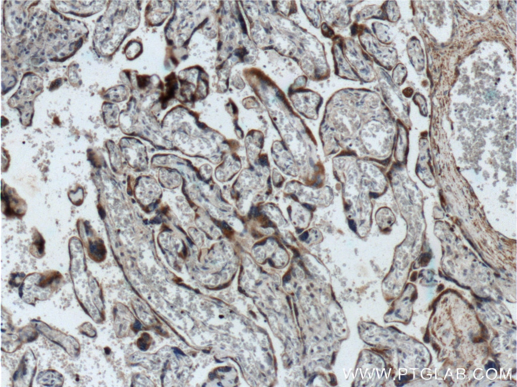Immunohistochemistry (IHC) staining of human placenta tissue using TLR4 Polyclonal antibody (19811-1-AP)
