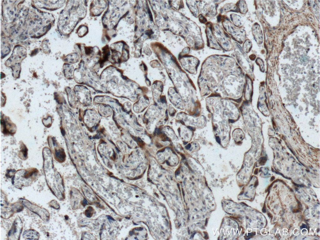 IHC staining of human placenta using 19811-1-AP