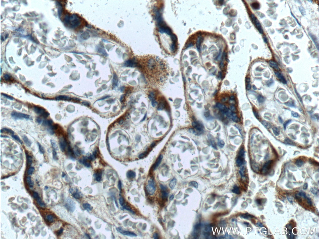 Immunohistochemistry (IHC) staining of human placenta tissue using TLR4 Polyclonal antibody (19811-1-AP)