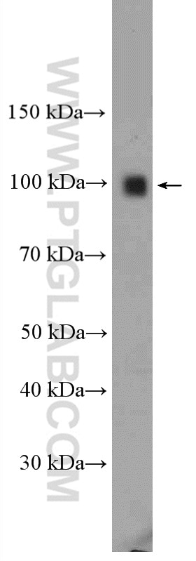 Western Blot (WB) analysis of mouse liver tissue using TLR4 Polyclonal antibody (19811-1-AP)