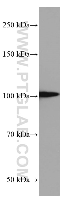 Western Blot (WB) analysis of pig liver tissue using TLR4 Monoclonal antibody (66350-1-Ig)