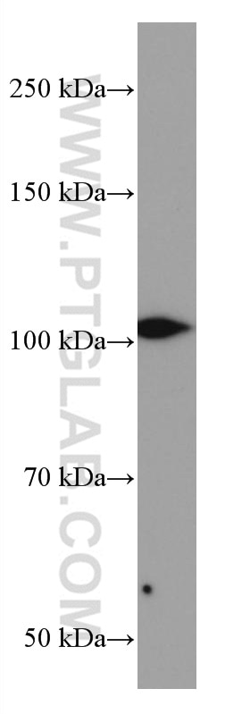 Western Blot (WB) analysis of rat liver tissue using TLR4 Monoclonal antibody (66350-1-Ig)