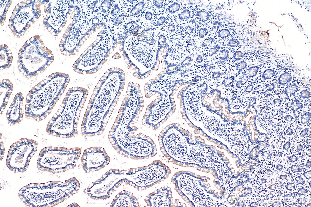 Immunohistochemistry (IHC) staining of human small intestine tissue using TLR5 Polyclonal antibody (19810-1-AP)