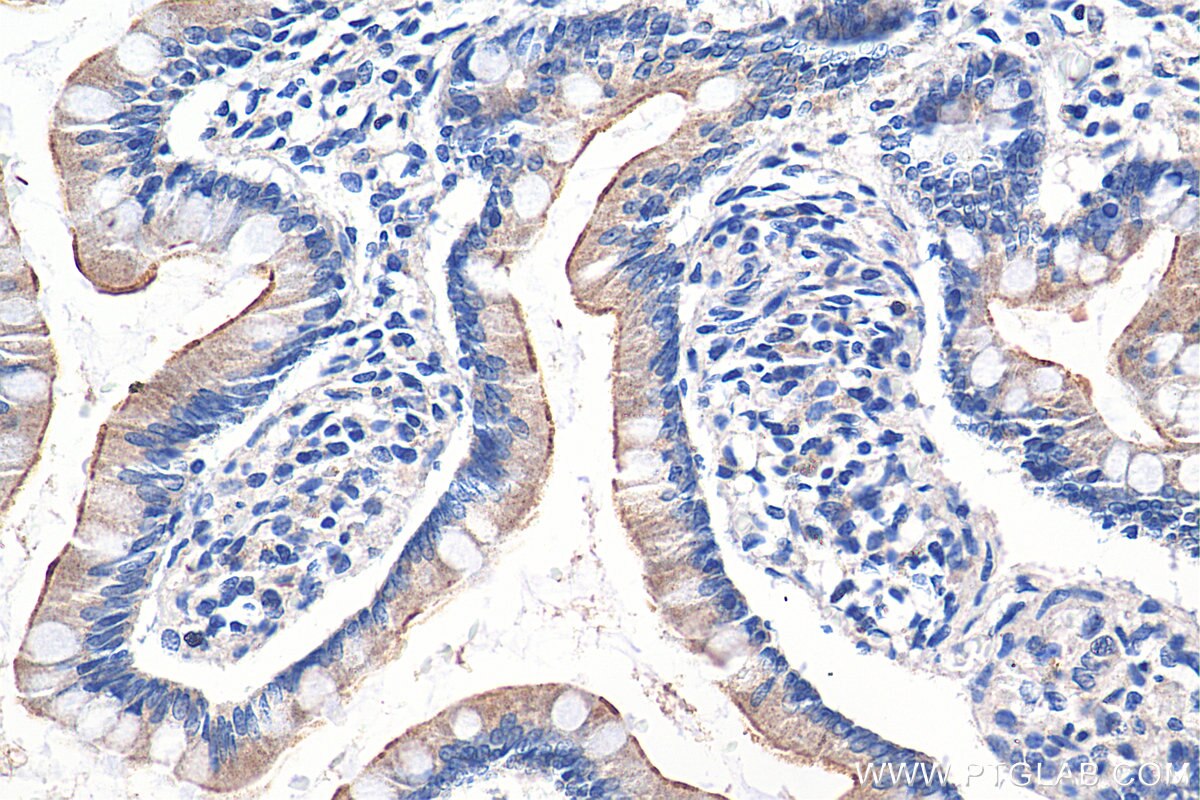 Immunohistochemistry (IHC) staining of human small intestine tissue using TLR5 Polyclonal antibody (19810-1-AP)