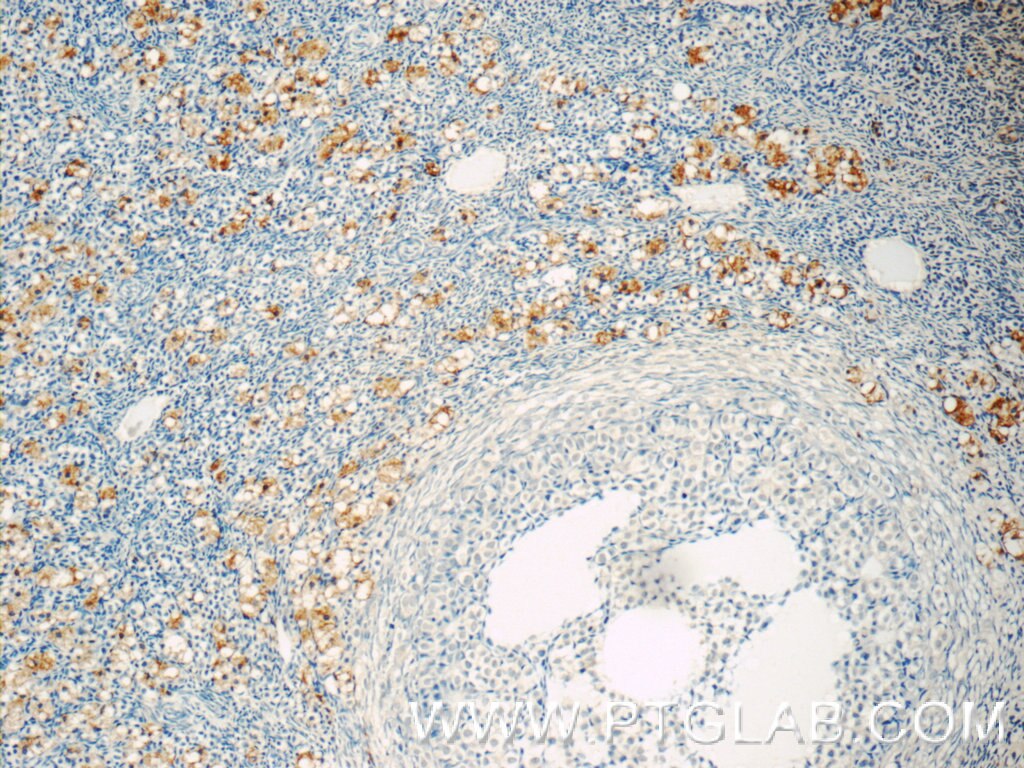 Immunohistochemistry (IHC) staining of human ovary tissue using TLR5 Polyclonal antibody (19810-1-AP)