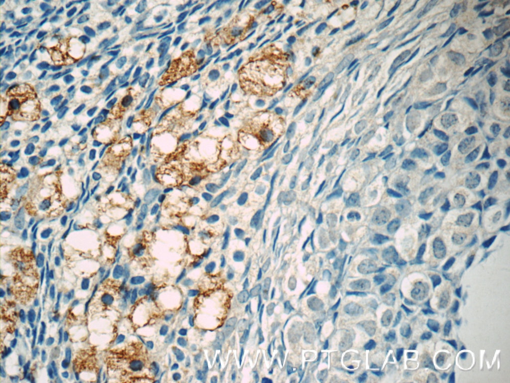 Immunohistochemistry (IHC) staining of human ovary tissue using TLR5 Polyclonal antibody (19810-1-AP)