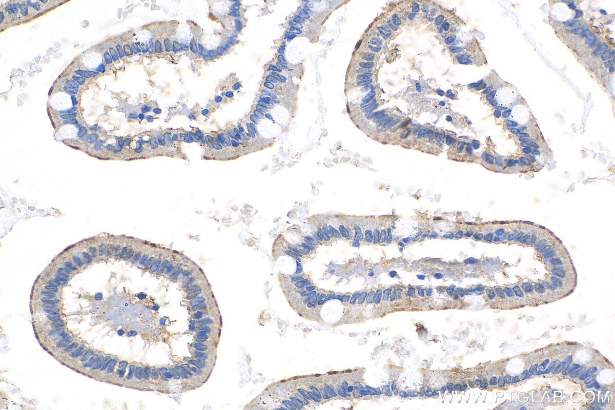 Immunohistochemistry (IHC) staining of human small intestine tissue using TLR5 Polyclonal antibody (19810-1-AP)